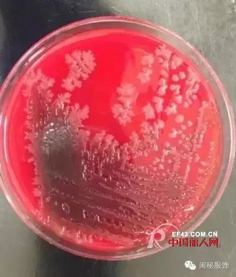 姑娘们 穿了一天的胸罩你知道有多脏吗？