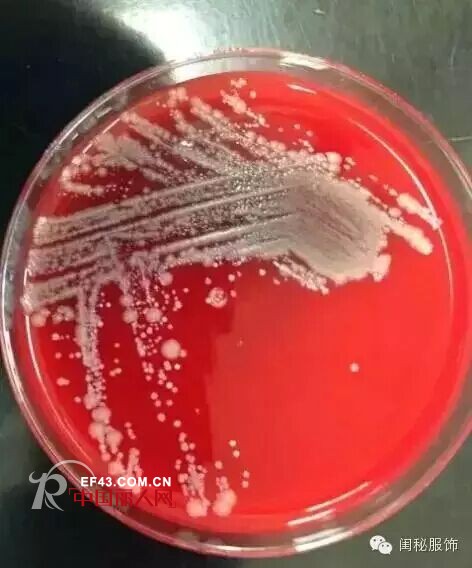 姑娘们 穿了一天的胸罩你知道有多脏吗？